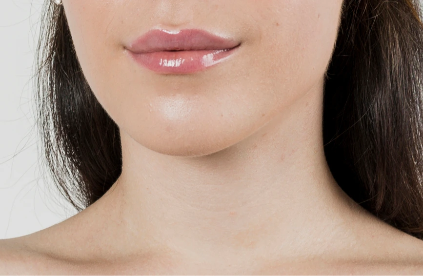 Techniques for Chin Liposuction Revision