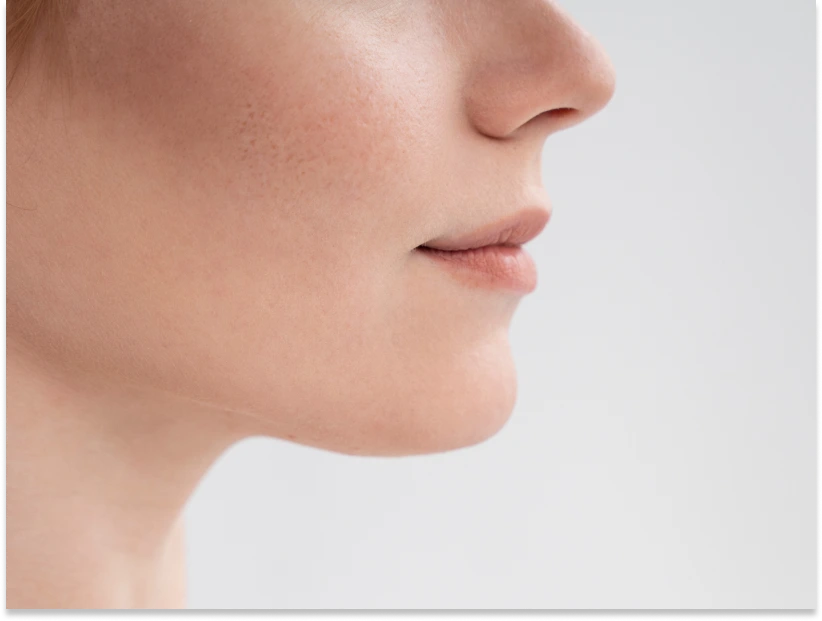 What Is Botched Chin Liposuction Surgery